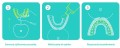 U-shaped sonic toothbrush, 360°