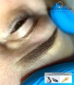 MAST - P10 handpiece - WQ367 for pigmentation, tattoo, for Hawk cartridges